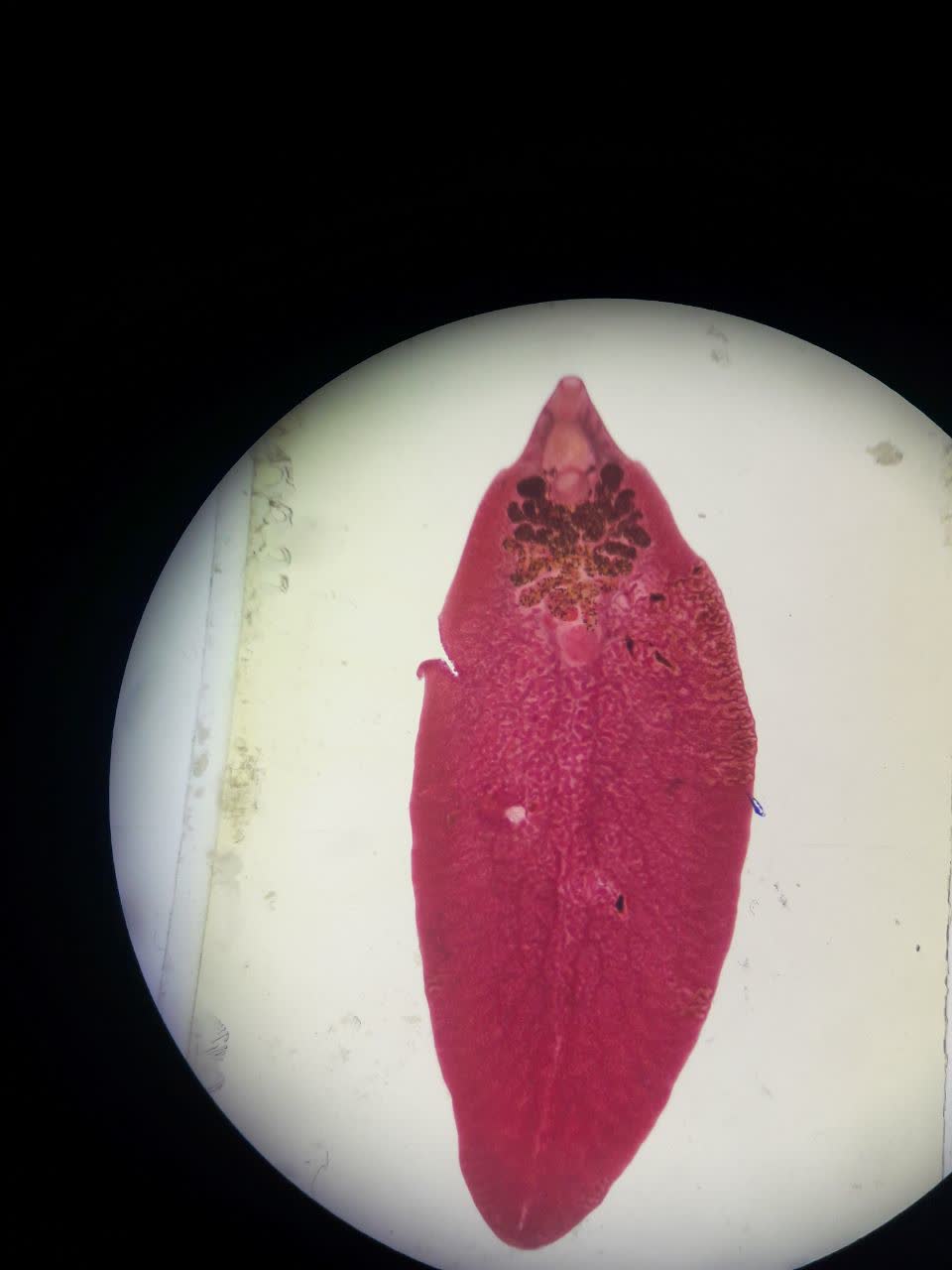 کرم بالغ فاسیولا هپاتیکا